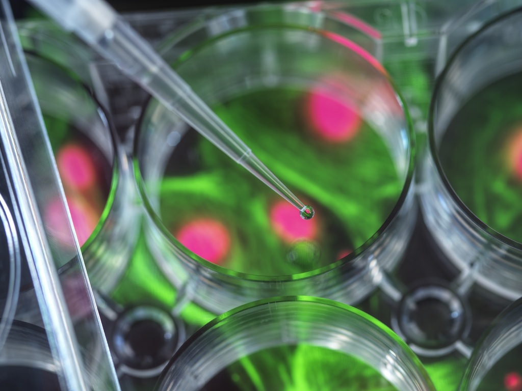Fluorescent Somatostatin Receptor Type 2 Internalization Assay cell line